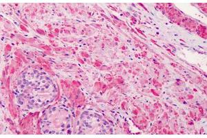 Human Prostate: Formalin-Fixed, Paraffin-Embedded (FFPE) (Vinculin Antikörper)
