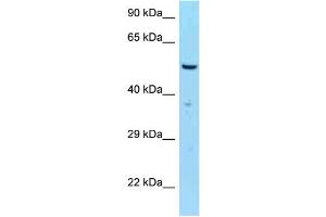 WB Suggested Anti-SASS6 Antibody Titration: 1. (SASS6 Antikörper  (C-Term))