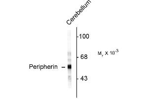 Western blots of rat cerebellar lysate showing specific immunolabeling of the ~ 57k peripherin protein. (Peripherin Antikörper)