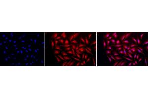 Immunocytochemistry/Immunofluorescence analysis using Rabbit Anti-GRP94 Polyclonal Antibody (ABIN1686652 and ABIN1686653). (GRP94 Antikörper  (C-Term))