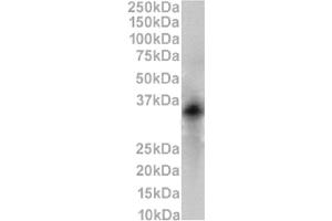 Western Blot using anti-CD79b antibody HM79-16. (Rekombinanter CD79b Antikörper)