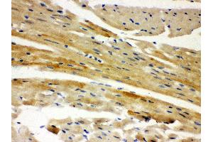 Anti- AIF Picoband antibody, IHC(P) IHC(P): Mouse Cardiac Muscle Tissue
