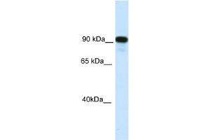 WB Suggested Anti-C2TA Antibody Titration:  0. (CIITA Antikörper  (C-Term))