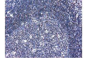 Immunohistochemical staining of paraffin-embedded Human lymph node tissue using anti-ANKRD53 mouse monoclonal antibody. (ANKRD53 Antikörper  (AA 1-300))