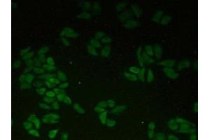 Detection of CTNNa1 in Human Hela Cells using Polyclonal Antibody to Catenin Alpha 1 (CTNNa1) (CTNNA1 Antikörper  (AA 2-228))