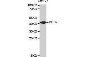 Western blot analysis of extracts of MCF-7 cell line, using DDB2 antibody. (DDB2 Antikörper  (AA 1-315))