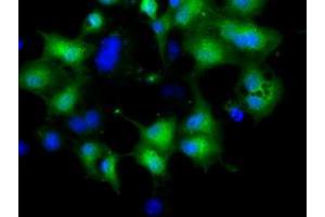 Anti-CRYM mouse monoclonal antibody (ABIN2452922) immunofluorescent staining of COS7 cells transiently transfected by pCMV6-ENTRY CRYM (RC218123). (CRYM Antikörper)