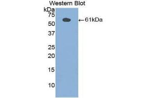 Western Blotting (WB) image for anti-Phospholipase A2-Activating Protein (PLAA) (AA 534-792) antibody (ABIN1860254)
