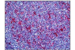 Immunohistochemistry (IHC) image for anti-Gelsolin (GSN) antibody (ABIN781885)