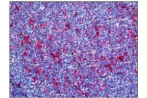 Immunohistochemistry (IHC) image for anti-Gelsolin (GSN) antibody (ABIN781885) (Gelsolin Antikörper)