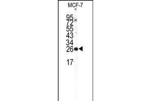 Western blot analysis of NCS1 Antibody in MCF-7 cell line lysates (35ug/lane) (NCS1 Antikörper  (AA 118-144))