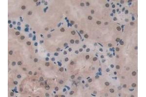 Immunohistochemistry (IHC) image for anti-Endoglin (ENG) (AA 27-137) antibody (ABIN7432973)