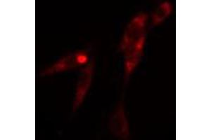 ABIN6274094 staining 293 cells by IF/ICC. (KLF11 Antikörper  (N-Term))