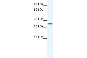 WB Suggested Anti-AIP Antibody Titration:  1. (AIP Antikörper  (N-Term))