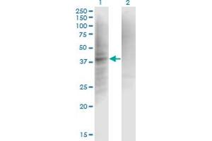 Western Blot analysis of CFI expression in transfected 293T cell line by IF monoclonal antibody (M01), clone 1B3.