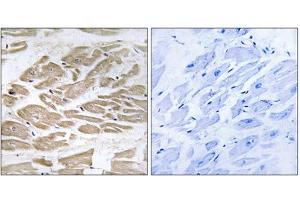 Immunohistochemistry analysis of paraffin-embedded human heart tissue using BRP44L antibody. (BRP44L Antikörper  (N-Term))