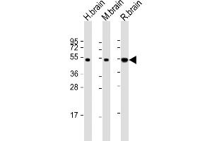Western Blotting (WB) image for anti-Neuronal Pentraxin 1 (NPX1) (AA 322-350) antibody (ABIN652309)