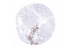 Immunohistochemistry (IHC) image for anti-Membrane-Spanning 4-Domains, Subfamily A, Member 1 (MS4A1) antibody (ABIN7477401)