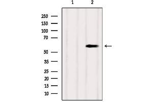 Western blot analysis of extracts from Mouse brain, using SUOX Antibody. (SUOX Antikörper  (Internal Region))