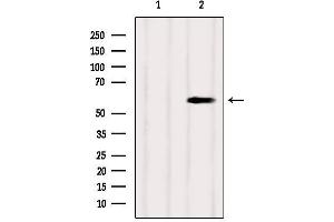 Western blot analysis of extracts from Mouse brain, using SUOX Antibody.