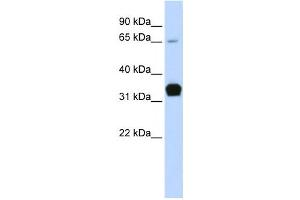 Western Blotting (WB) image for anti-Slow Skeletal Troponin T (TNNT1) antibody (ABIN2458625) (TNNT1 Antikörper)