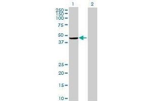 Lane 1: PARP15 transfected lysate ( 49. (PARP15 293T Cell Transient Overexpression Lysate(Denatured))