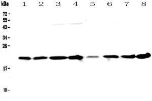 Western blot analysis of GLO1 using anti-GLO1 antibody . (GLO1 Antikörper  (AA 2-184))