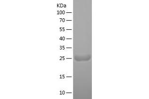 MYL4 Protein (AA 1-197) (His tag)