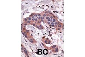 Immunohistochemistry (Paraffin-embedded Sections) (IHC (p)) image for anti-BH3 Interacting Domain Death Agonist (BID) (AA 68-103) antibody (ABIN388099)