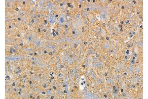 ABIN6265392 and ABIN6269172 at 1/100 staining Mouse brain tissue by IHC-P.