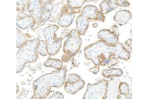 Immunohistochemistry (IHC) image for anti-Epidermal Growth Factor Receptor (EGFR) (C-Term) antibody (ABIN7795642) (Rekombinanter EGFR Antikörper  (C-Term))
