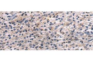 Immunohistochemistry of paraffin-embedded Human brain tissue using ANGPTL2 Polyclonal Antibody at dilution of 1:55(x200) (ANGPTL2 Antikörper)