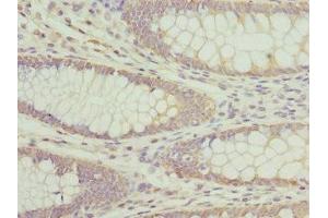 Immunohistochemistry (IHC) image for anti-Adaptor-Related Protein Complex 3, beta 1 Subunit (AP3B1) (AA 895-1094) antibody (ABIN7144377)