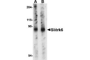 Western Blotting (WB) image for anti-SLIT and NTRK-Like Family, Member 6 (SLITRK6) (Middle Region) antibody (ABIN1031100) (SLITRK6 Antikörper  (Middle Region))