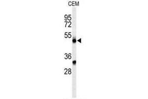 Western blot analysis of CFP Antibody (Center) in CEM cell line lysates (35µg/lane). (CFP Antikörper  (Middle Region))