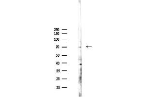 anti-E3 ubiquitin-protein ligase RAD18 (RAD18) (pSer99) antibody