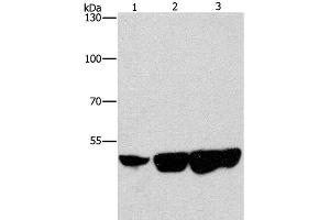 Western Blot analysis of Hela, hepG2 and 231 cell using CTBP2 Polyclonal Antibody at dilution of 1:400 (CTBP2 Antikörper)