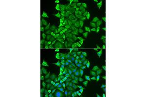 Immunofluorescence analysis of HeLa cell using CARS antibody. (CARS Antikörper)