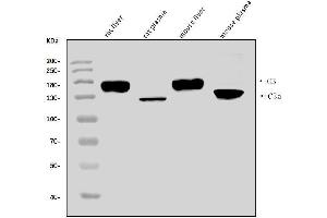 Western blot analysis of C3 using anti-C3 antibody (ABIN7599899).