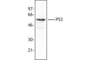 Western Blotting (WB) image for anti-Tumor Protein P53 (TP53) antibody (ABIN2664004) (p53 Antikörper)