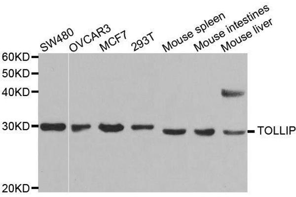 TOLLIP anticorps  (AA 1-274)