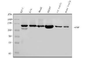 Western blot analysis of PARP using anti-PARP antibody (ABIN7602276).