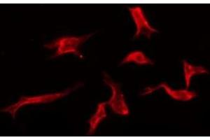 ABIN6276144 staining Hela by IF/ICC. (OR3A2 Antikörper  (C-Term))