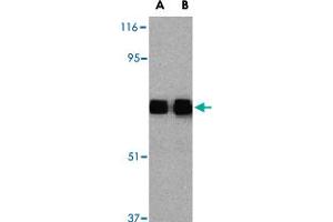Western blot analysis of TLR10 in human lymph node tissue lysates with TLR10 polyclonal antibody  at (A) 0.