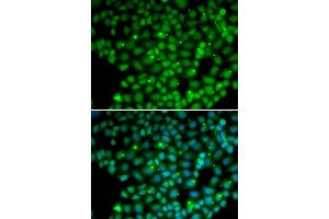 Immunofluorescence analysis of U2OS cells using MUTYH antibody (ABIN5970784). (MUTYH Antikörper)