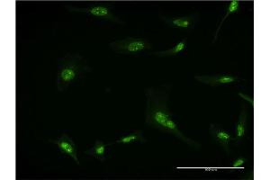 Immunofluorescence of monoclonal antibody to RPL7 on HeLa cell. (RPL7 Antikörper  (AA 158-248))