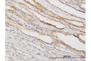 Immunostaining (ISt) image for anti-Protein Geranylgeranyltransferase Type I, beta Subunit (PGGT1B) (AA 1-105) antibody (ABIN562194)