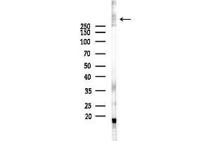 anti-Low Density Lipoprotein Receptor-Related Protein 1B (LRP1B) (N-Term) antibody