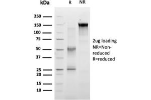 SDS-PAGE Analysis of Purified RET Mouse Monoclonal Antibody (RET/2663).