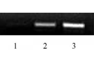 Histone H2B acetyl Lys46 pAb tested by ChIP. (Histone H2B Antikörper  (acLys46))